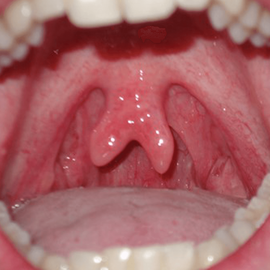 DU_dermato_module1bis