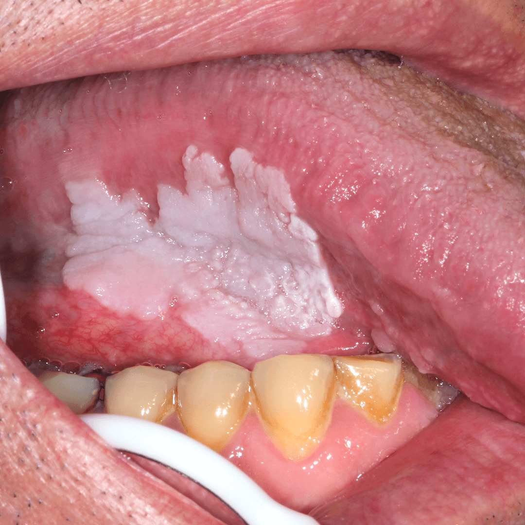 DU_dermato_module3