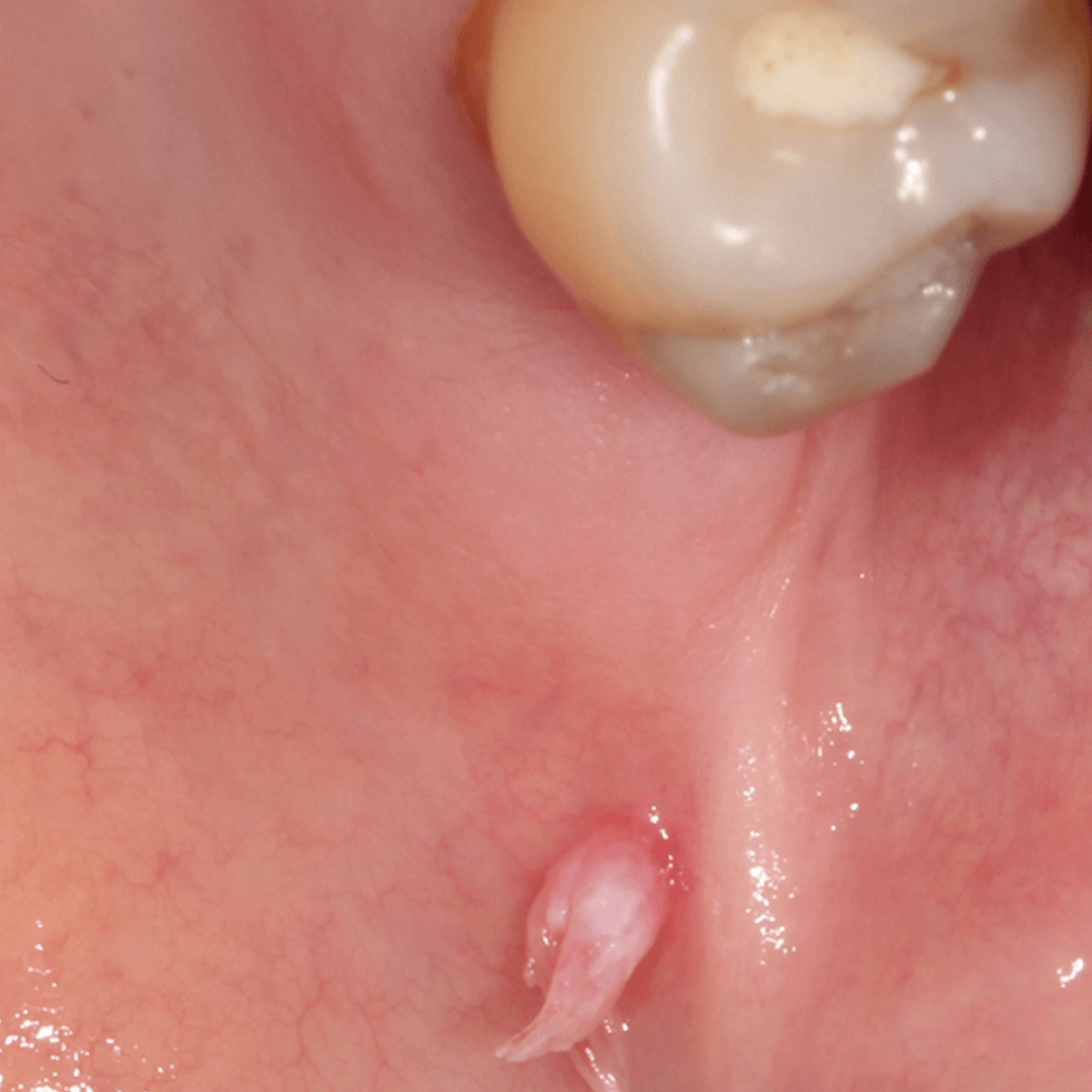 DU_dermato_module4bis