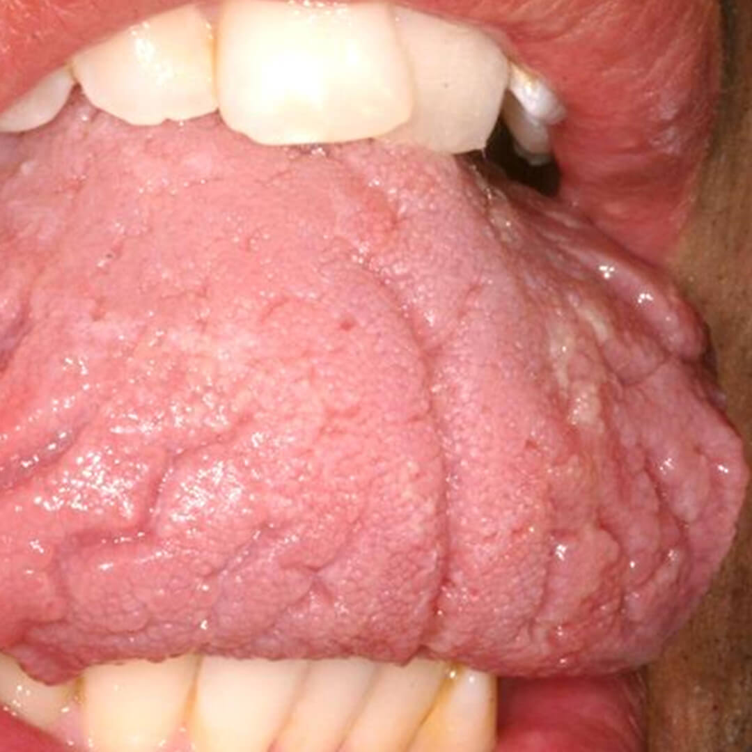 DU_produit_dermatologie_buccale_produit_nice